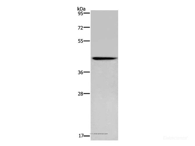 Western Blot analysis of Human fetal brain tissue using CERS5 Polyclonal Antibody at dilution of 1:350