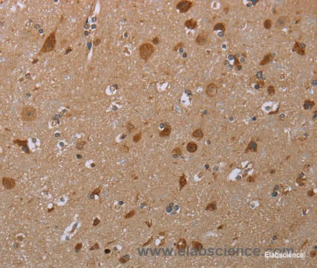 Immunohistochemistry of paraffin-embedded Human brain tissue using MARK1 Polyclonal Antibody at dilution 1:30