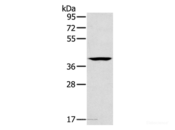 Western Blot analysis of Lovo cell using CAB39 Polyclonal Antibody at dilution of 1:200