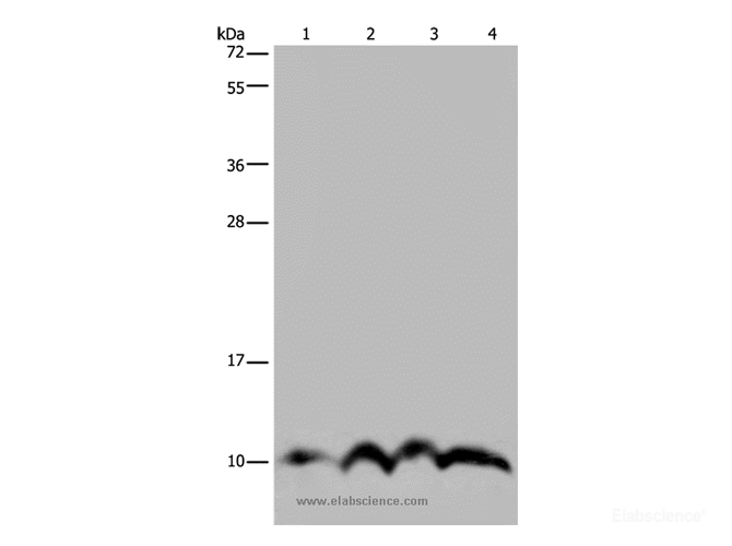 Western Blot analysis of SKOV3 cell and Human fetal liver tissue, Human fetal brain tissue and Hela cell using NDUFA4 Polyclonal Antibody at dilution of 1:300