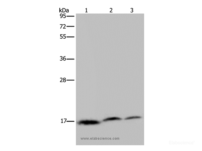 Western Blot analysis of Jurkat, Hela and K562 cell using NDUFAF4 Polyclonal Antibody at dilution of 1:350