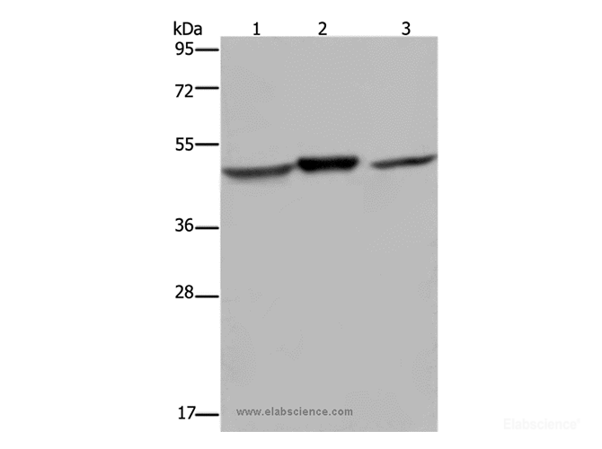 Western Blot analysis of Mouse heart and brain tissue, Jurkat cell using NDUFS2 Polyclonal Antibody at dilution of 1:400