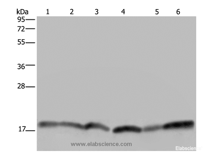 Western Blot analysis of Human brain malignant glioma tissue, Jurkat, Raji and 231 cell, Human fetal brain tissue and Hela cell using RHEB Polyclonal Antibody at dilution of 1:300