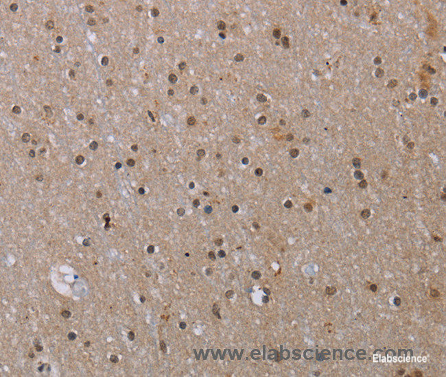 Immunohistochemistry of paraffin-embedded Human brain tissue using MED12 Polyclonal Antibody at dilution 1:40