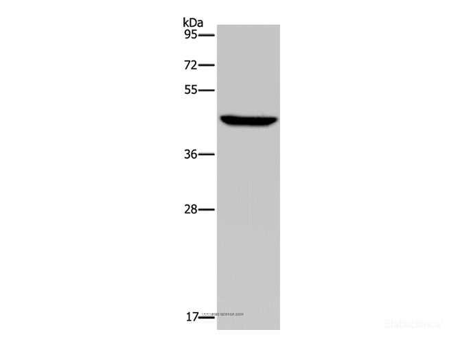 Western Blot analysis of Hela cell using PDSS2 Polyclonal Antibody at dilution of 1:400