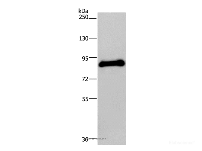 Western Blot analysis of Human testis tissue using POMT1 Polyclonal Antibody at dilution of 1:200