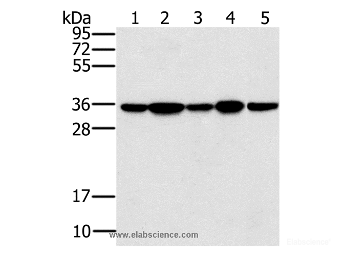Western Blot analysis of Jurkat, 293T and hela cell, Mouse brain tissue and K562 cell using PPP1CC Polyclonal Antibody at dilution of 1:200