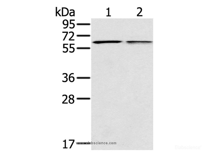 Western Blot analysis of Mouse liver and lung tissue using PTGER2 Polyclonal Antibody at dilution of 1:200