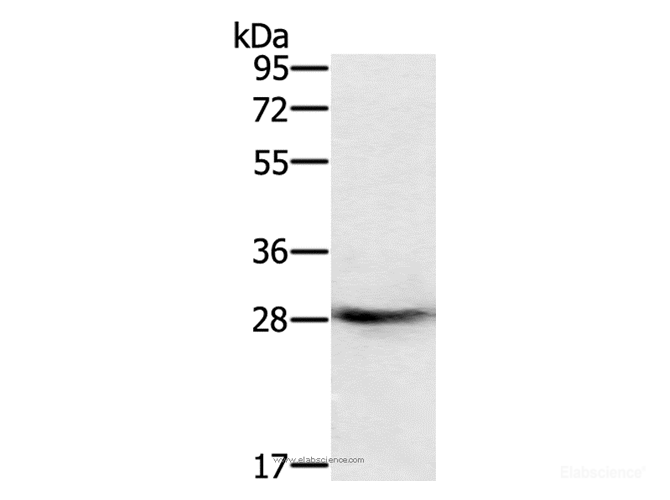 Western Blot analysis of Human normal colon tissue using RAB8B Polyclonal Antibody at dilution of 1:400