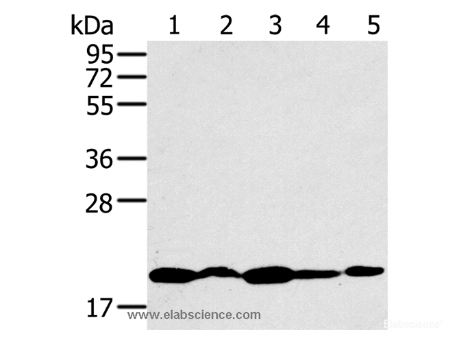 Western Blot analysis of K562, 231, Jurkat, hela and 293T cell using RNF5 Polyclonal Antibody at dilution of 1:200