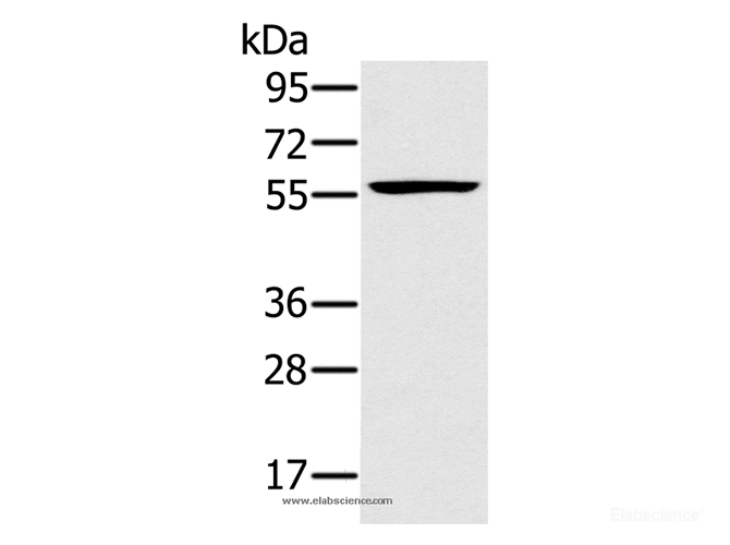 Western Blot analysis of Jurkat cell using TRIM34 Polyclonal Antibody at dilution of 1:250