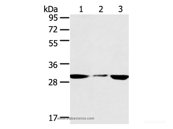 Western Blot analysis of PC3 and hepg2 cell, Human fetal liver tissue using SDHB Polyclonal Antibody at dilution of 1:400