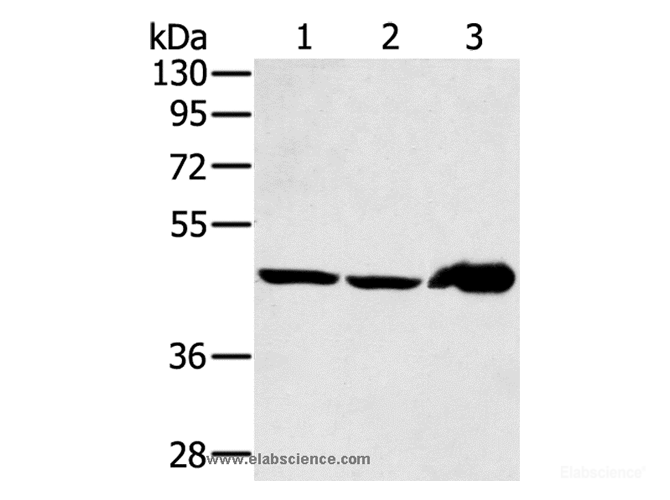 Western Blot analysis of Mouse liver tissue and PC3 cell, Human fetal liver tissue using SEC14L2 Polyclonal Antibody at dilution of 1:400