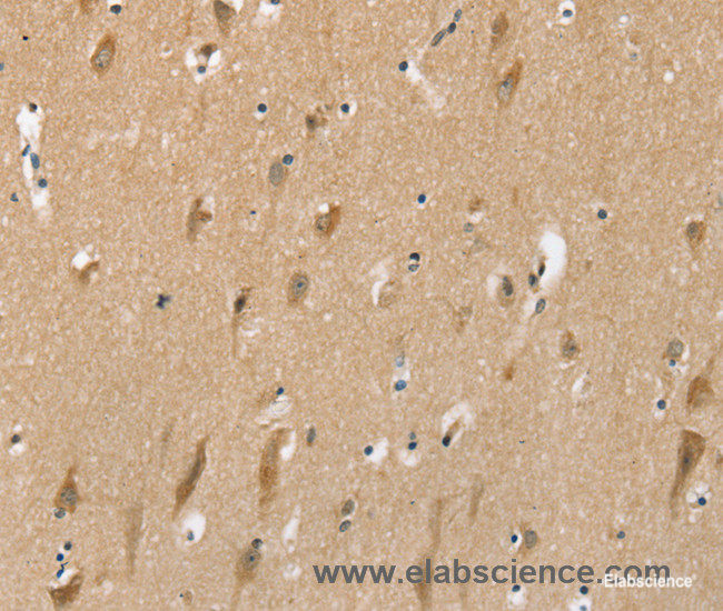 Immunohistochemistry of paraffin-embedded Human brain tissue using SLC6A7 Polyclonal Antibody at dilution 1:30