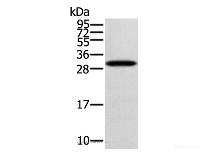 Western Blot analysis of Human fetal brain tissue using STARD5 Polyclonal Antibody at dilution of 1:400