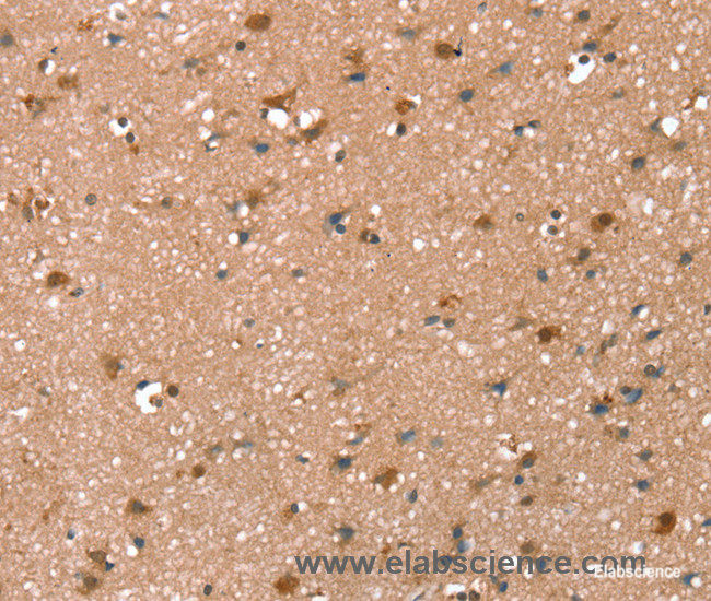 Immunohistochemistry of paraffin-embedded Human brain tissue using SYNPO2 Polyclonal Antibody at dilution 1:50