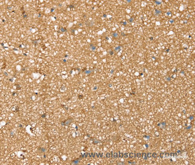 Immunohistochemistry of paraffin-embedded Human brain tissue using SDC3 Polyclonal Antibody at dilution 1:45