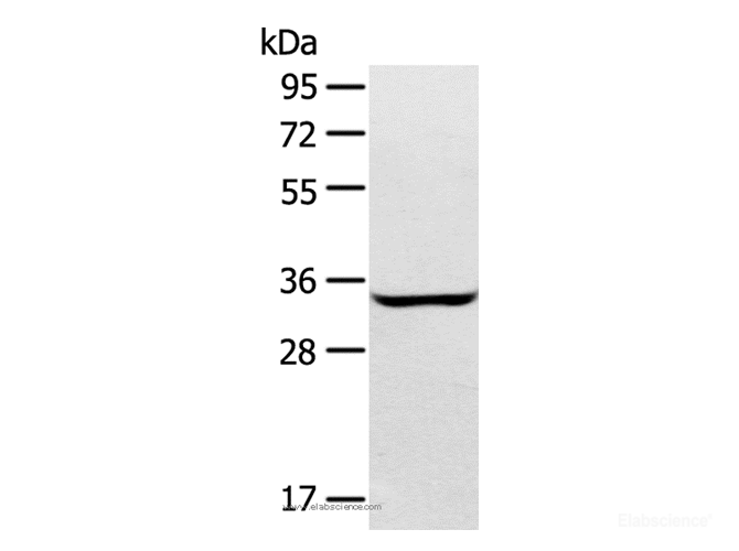 Western Blot analysis of A172 cell using STX2 Polyclonal Antibody at dilution of 1:400