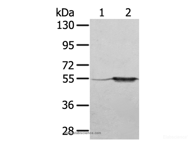 Western Blot analysis of A375 cell and Human fetal muscle tissue using TRIM35 Polyclonal Antibody at dilution of 1:550