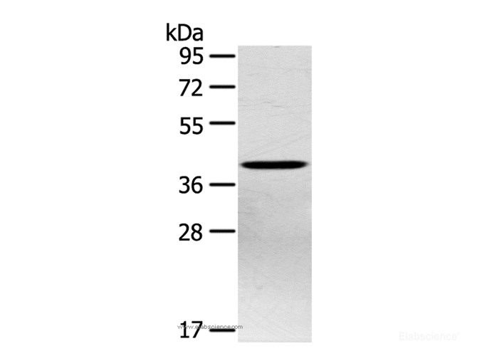 Western Blot analysis of Hepg2 cell using PTX3 Polyclonal Antibody at dilution of 1:400