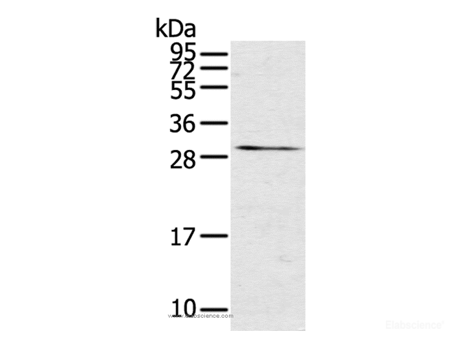 Western Blot analysis of Mouse kidney tissue using TNFSF15 Polyclonal Antibody at dilution of 1:600