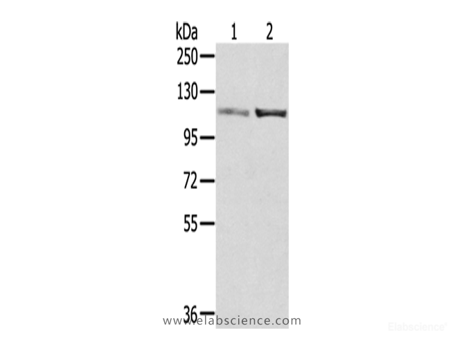 Western Blot analysis of A172 and 231 cells using SENP7 Polyclonal Antibody at dilution of 1/800