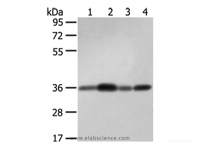 Western Blot analysis of 231, 293T and hepg2 cell, Mouse brain tissue using STX12 Polyclonal Antibody at dilution of 1/400