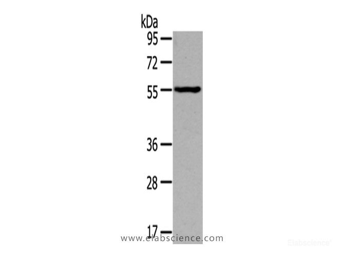 Western Blot analysis of Mouse muscle tissue using THRA Polyclonal Antibody at dilution of 1/400