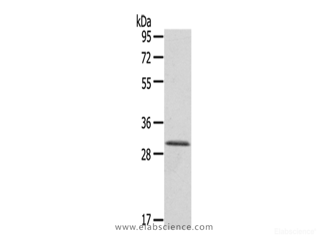 Western Blot analysis of A431 cells using HTATIP2 Polyclonal Antibody at dilution of 1/800