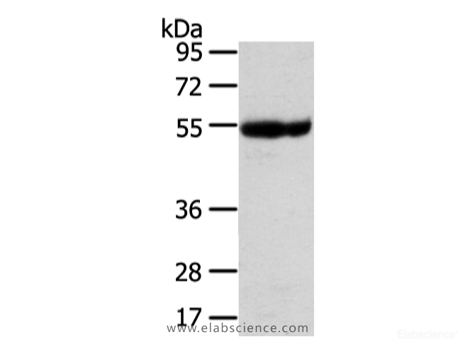 Western Blot analysis of Human placenta tissue using UBAP1 Polyclonal Antibody at dilution of 1/400