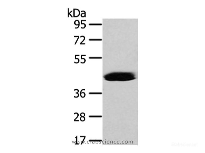Western Blot analysis of Hela cell using VASH2 Polyclonal Antibody at dilution of 1/450