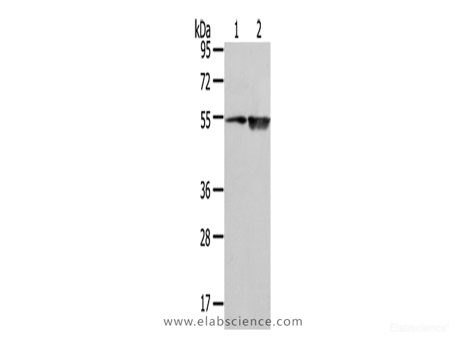 Western Blot analysis of TM4 cell and Human placenta tissue using EAAT3 Polyclonal Antibody at dilution of 1/500