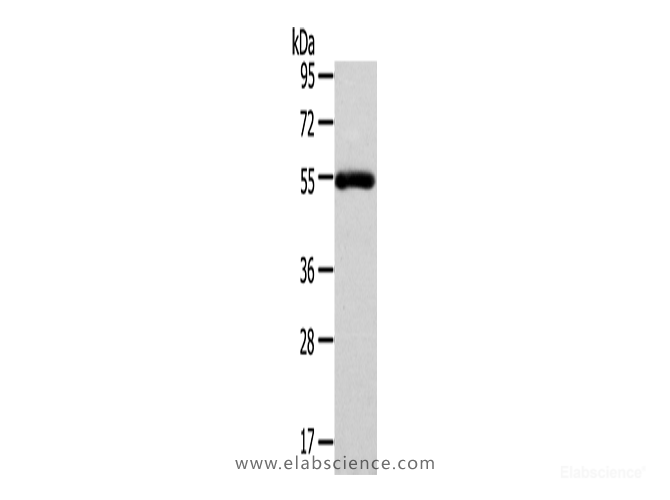 Western Blot analysis of Human normal liver tissue using FOXC1 Polyclonal Antibody at dilution of 1/400