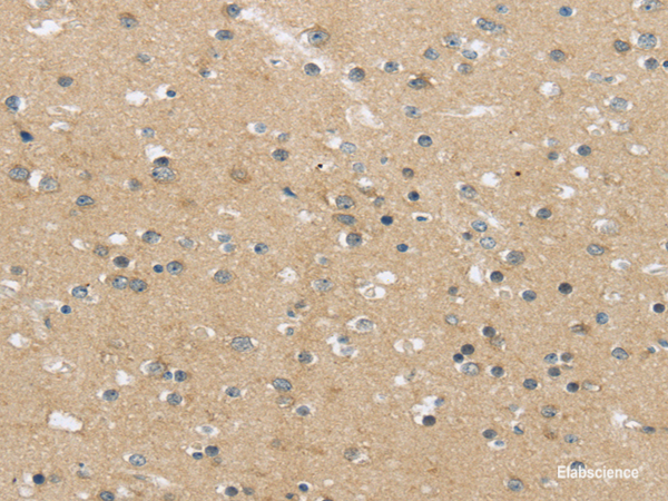 Immunohistochemistry of paraffin-embedded Human brain using MPP6 Polyclonal Antibody at dilution of  1/25