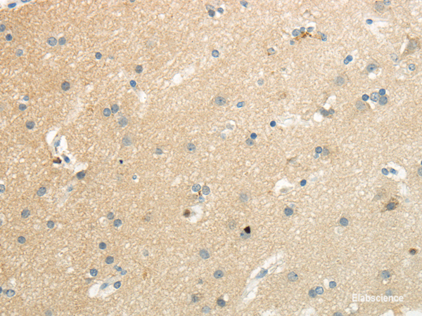 Immunohistochemistry of paraffin-embedded Human brain using SLC7A11 Polyclonal Antibody at dilution of  1/35