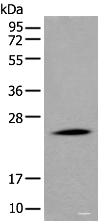 Western blot analysis of Human liver tissue lysate  using APOD Polyclonal Antibody at dilution of 1:550