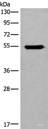 Western blot analysis of HEPG2 cell lysate  using CYP11B2 Polyclonal Antibody at dilution of 1:650
