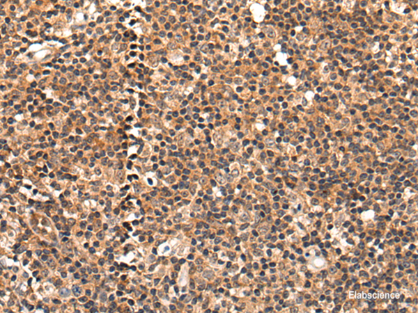 Immunohistochemistry of paraffin-embedded Human tonsil tissue  using C16orf45 Polyclonal Antibody at dilution of 1:45(×200)
