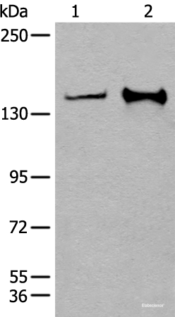 Western blot analysis of Hela and A172 cell lysates  using CAPN15 Polyclonal Antibody at dilution of 1:400