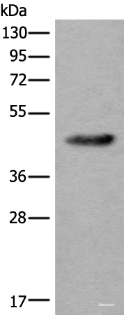 Western blot analysis of Human heart tissue lysate  using CDKL4 Polyclonal Antibody at dilution of 1:550