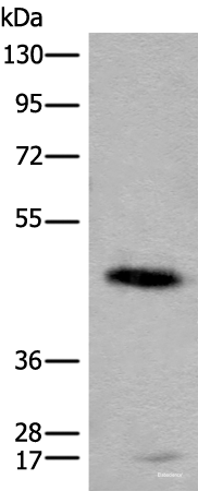 Western blot analysis of Human cerebella tissue lysate  using CADM2 Polyclonal Antibody at dilution of 1:2000