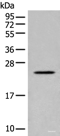Western blot analysis of Human placenta tissue lysate  using CARD16 Polyclonal Antibody at dilution of 1:800