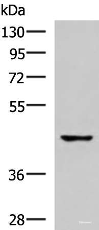 Western blot analysis of 293T cell lysate  using TNFRSF10D Polyclonal Antibody at dilution of 1:500