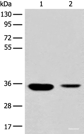 Western blot analysis of Mouse liver tissue and Human fetal liver tissue lysates  using RGN Polyclonal Antibody at dilution of 1:500