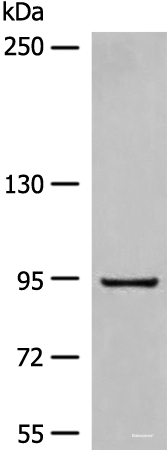Western blot analysis of Human fetal liver tissue lysate  using DMGDH Polyclonal Antibody at dilution of 1:800