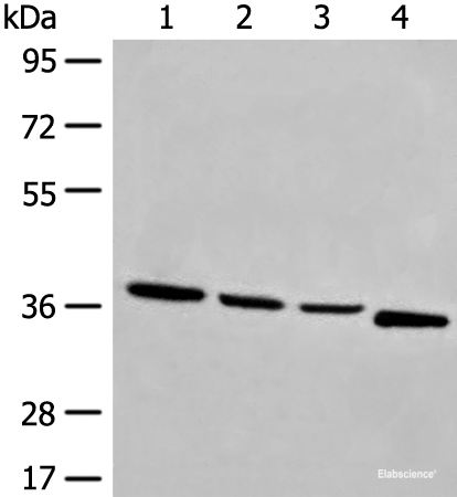 Western blot analysis of Human breast cancer tissue TM4 231 and Jurkat cell lysates  using OTUD6A Polyclonal Antibody at dilution of 1:550
