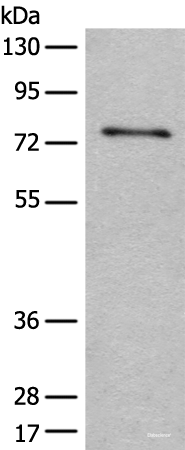 Western blot analysis of Human hepatocellular carcinoma 2 tissue lysate  using ADGRE3 Polyclonal Antibody at dilution of 1:400