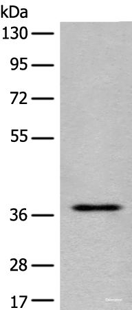Western blot analysis of Jurkat cell lysate  using EN2 Polyclonal Antibody at dilution of 1:400
