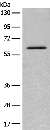 Western blot analysis of Mouse lung tissue lysate  using ENO4 Polyclonal Antibody at dilution of 1:450