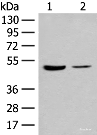 Western blot analysis of Human fetal brain tissue and Jurkat cell lysates  using IL7R Polyclonal Antibody at dilution of 1:500